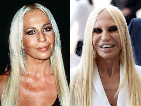 donatella versace antes y después